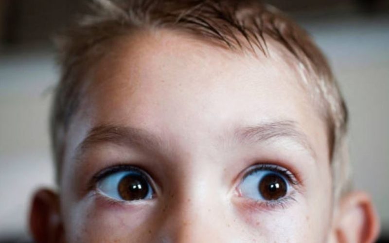 Retinoblastoma - Casa Pediátrica