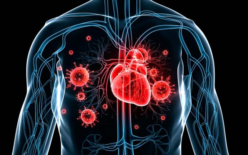 Prevención contra Endocarditis Infecciosa. - Casa Pediátrica