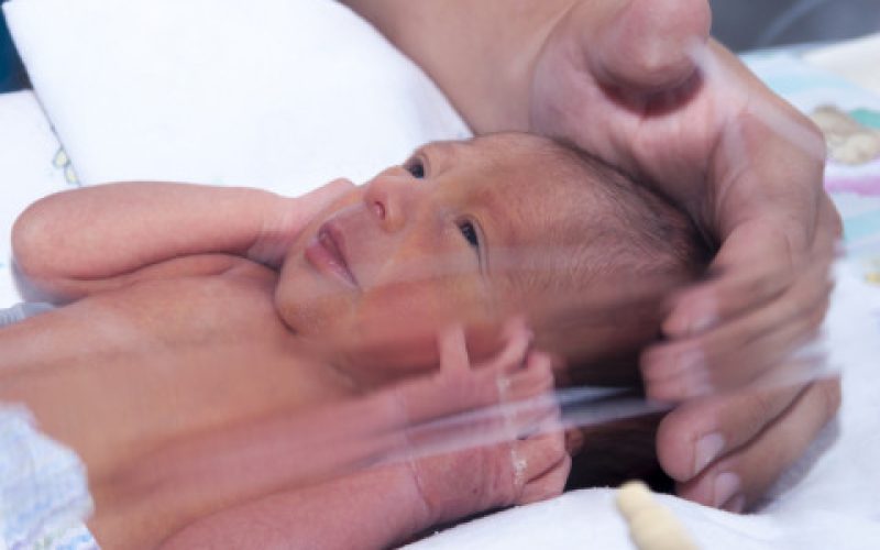 ANEMIA EN EL RECIÉN NACIDO PREMATURO - Casa Pediátrica